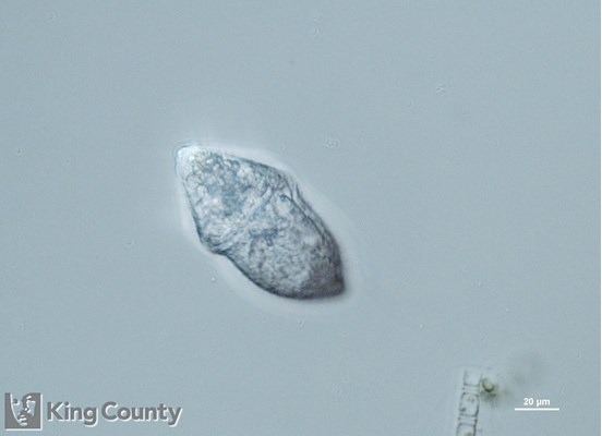 Photo of Gymnodinium rubrum